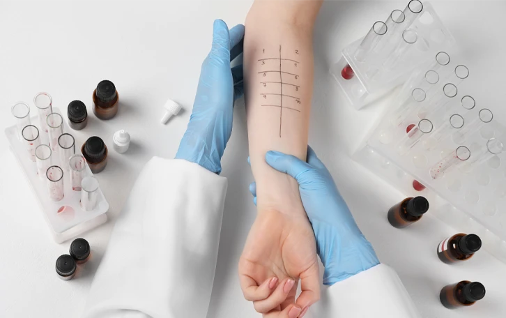 An einem Arm wird ein Pricktest druchgeführt. Drum herum sind Reagenzgläser in Haltern