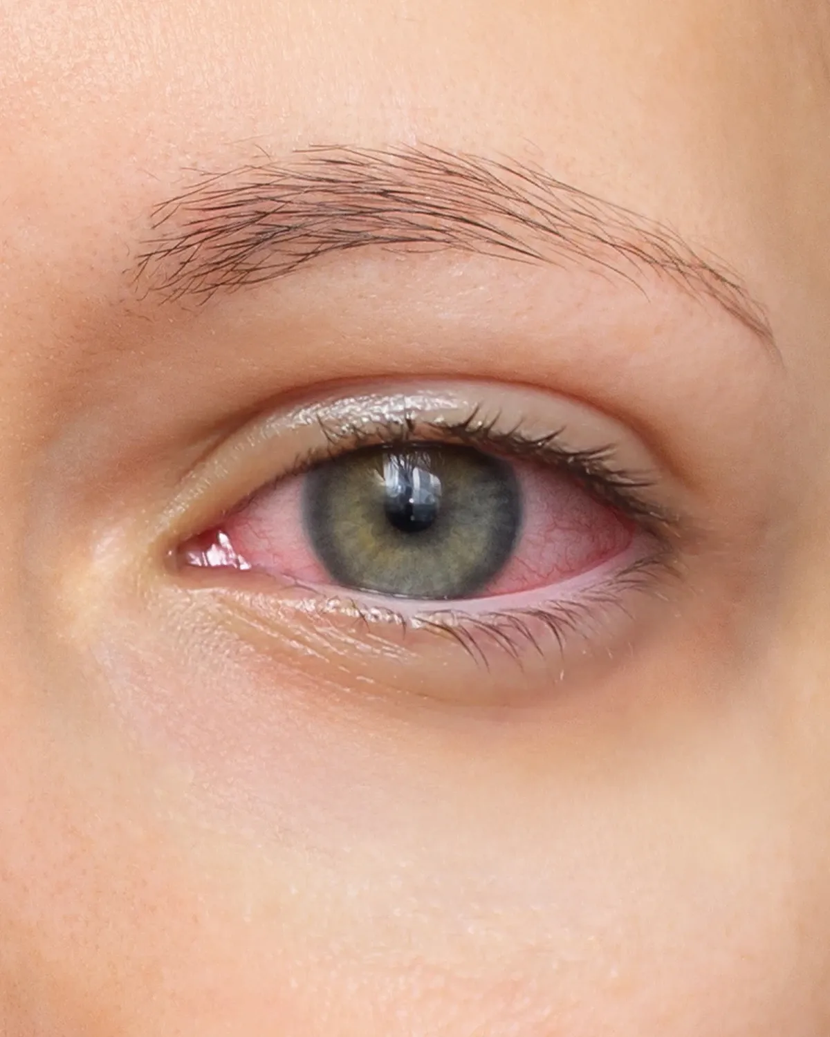 Nahaufnahme eines geröteten Auges